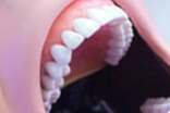 牙龈流血是怎么回事